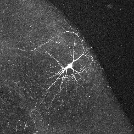 Microscopic image of a neuron with branching dendrites